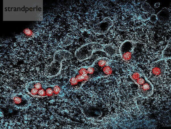 Transmission electron micrograph of West Nile virus particles (red) replicating within the cytoplasm of an infected VERO E6 cell (blue).